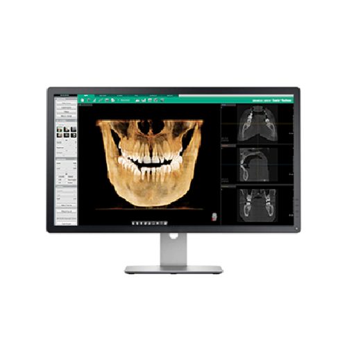 Software imagistica dentara Ez3Di