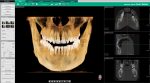 Software imagistica dentara Ez3Di