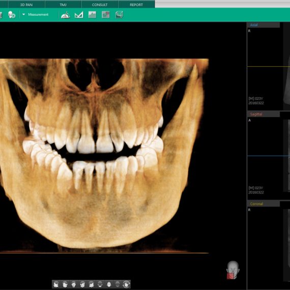 Software imagistica dentara Ez3Di