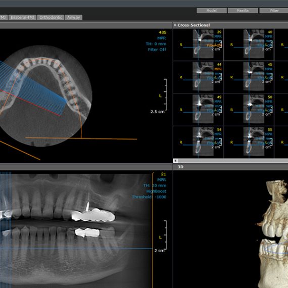 OnDemand3D Software management Imagistica Dentara