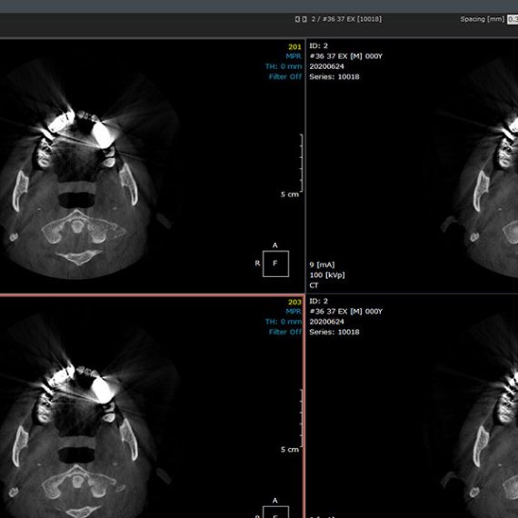 OnDemand3D Software management Imagistica Dentara