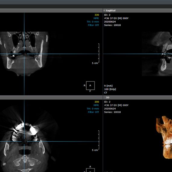 OnDemand3D Software management Imagistica Dentara