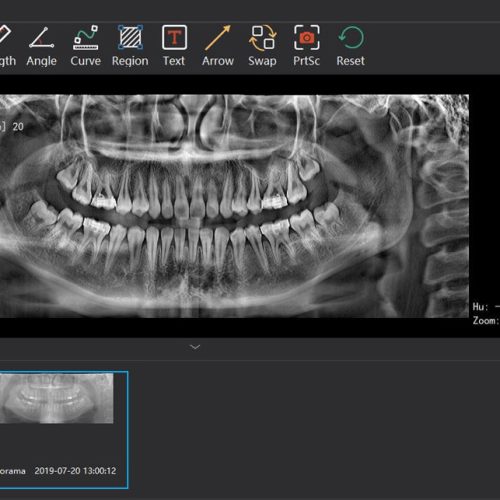 Orthodontic software / for dental restorations / 3D viewing / 3D simulation