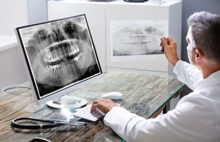 radiografia panoramica vs Bitewing vs CBCT