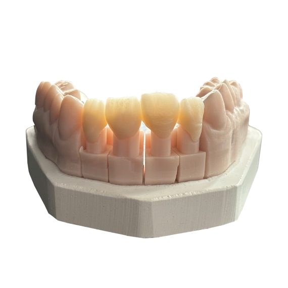 Imprimanta 3D DFAB Chairside